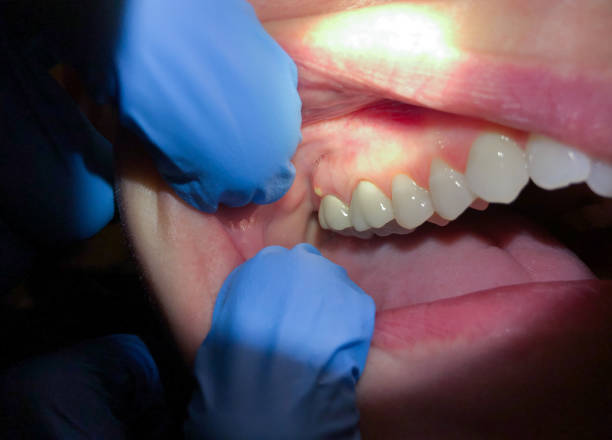 Best Emergency Treatment for Jaw Pain or Injury in Wolfdale, PA