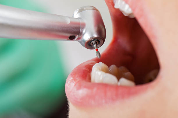 Best Emergency Treatment for Oral Infections in Wolfdale, PA